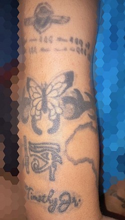 Right outside upper arm